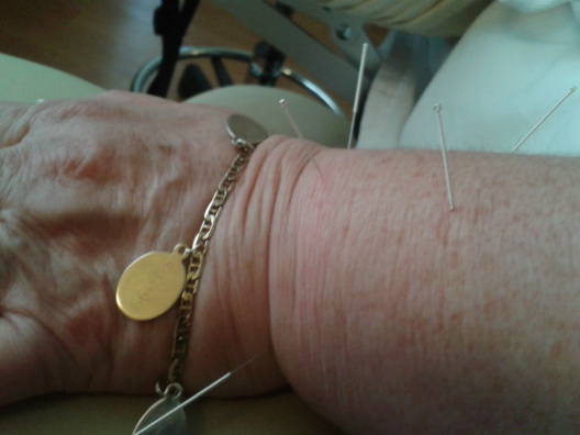 Omaha Acupuncture