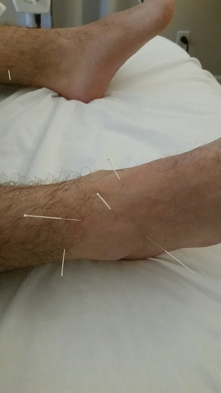 Omaha Acupuncture and Chiropractic